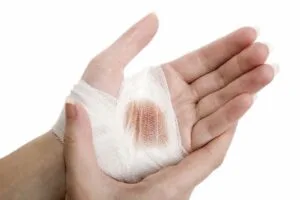 Mơ thấy bị thương mang ý nghĩa gì?