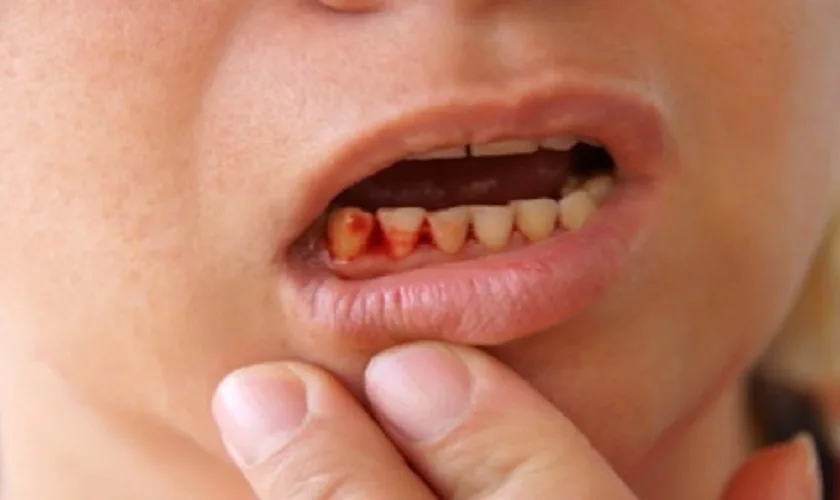 Nằm mơ thấy máu trong miệng là điềm báo gì? Đánh con số nào?